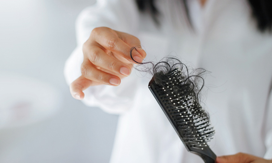 علاجات وحلول تساقط الشعر