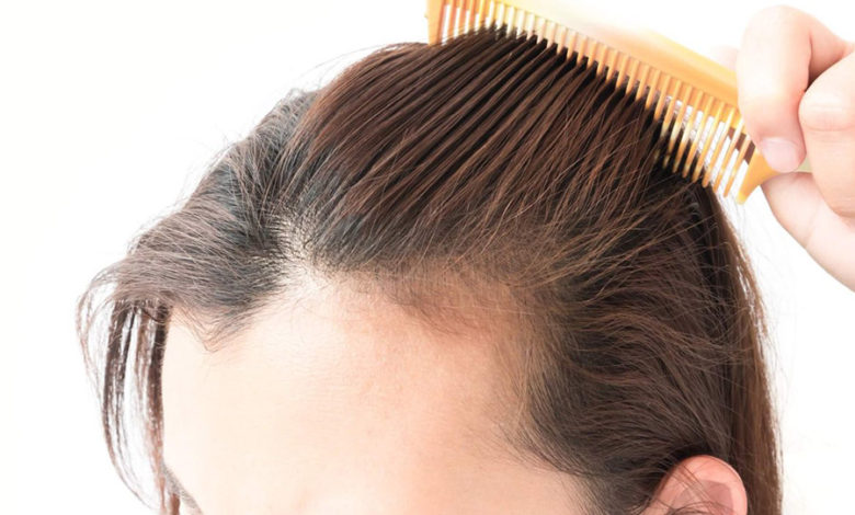 أحدث علاجات تساقط الشعر