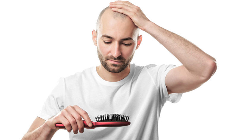 علاج تساقط الشعر للرجال الوراثي