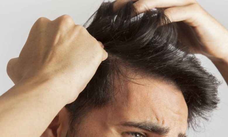 خطورة زراعة الشعر